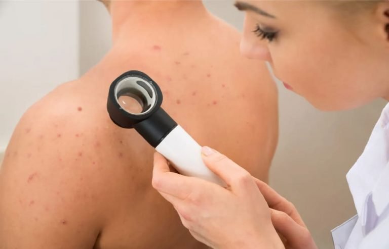 Dermatologia Clínica - Dra. Camille Vieira - Dermatologia